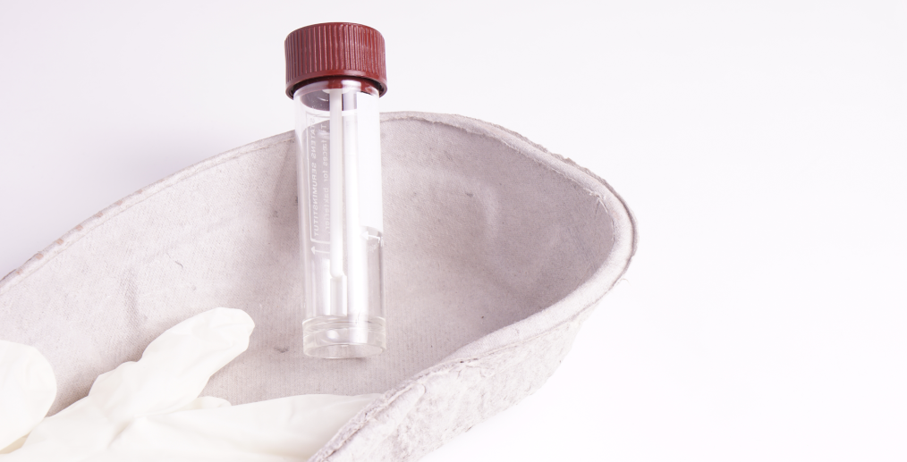 Recoltarea probei de scaun se face cu ajutorul unui recipient special