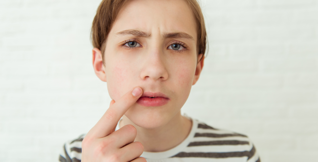 Semne de pubertate precoce la băieți