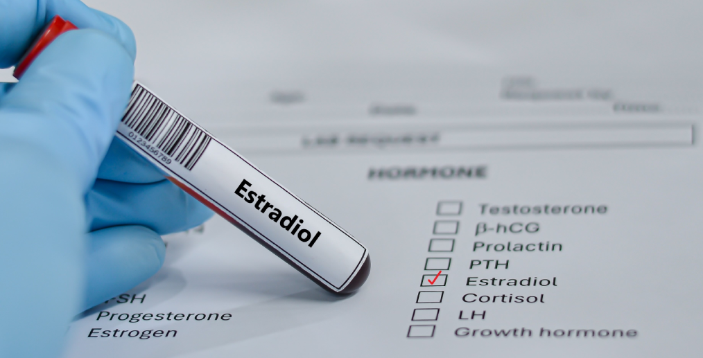 Analiză pentru evaluarea estradiolului