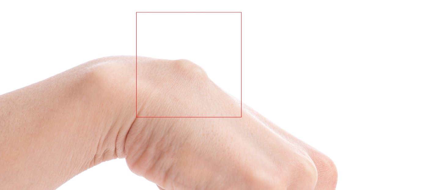 Totul despre lichidul sinovial: ce este, ce roluri îndeplinește, când indică o afecțiune