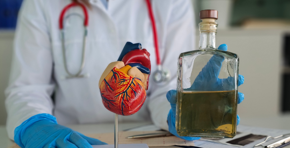 riscuri cardiovasculare