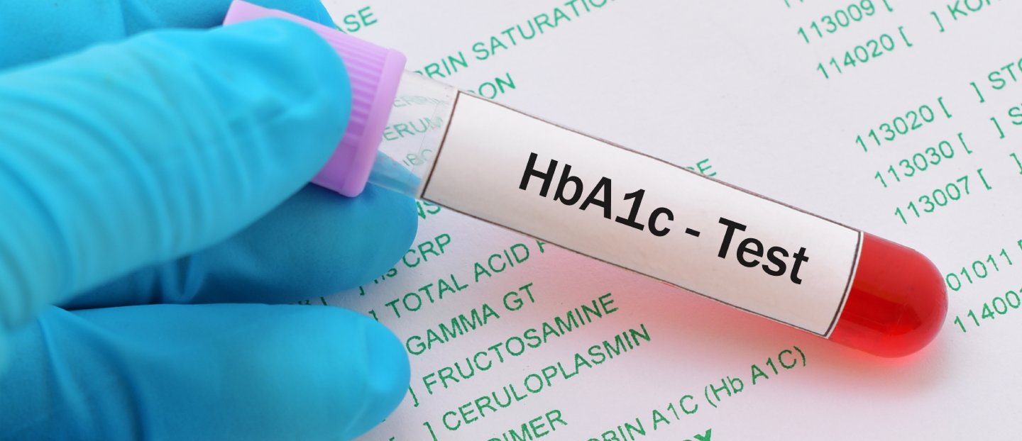 Prediabetul: hemoglobina glicozilată (HbA1c) – analiza care depistează riscul de diabet?