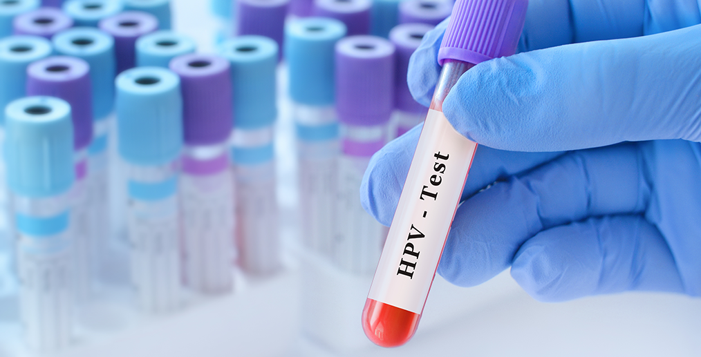 Text HPV