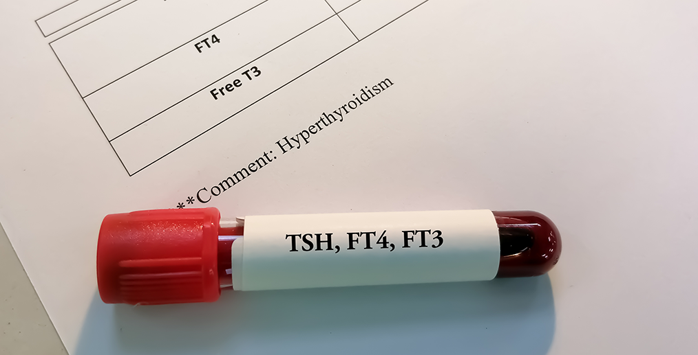 analize-tsh-ft4
