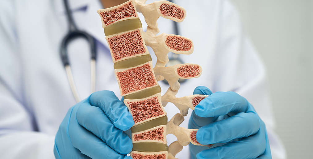 Osteoporoză