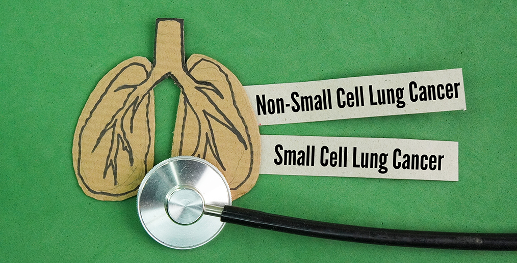 tipuri-de-cancer-pulmonar