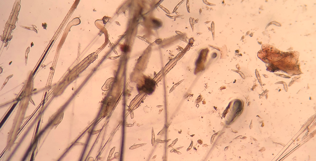 folicul-pilos-microscop-demodex