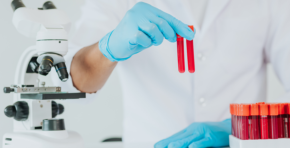 analize-sange-diagnostic-cancer-pulmonar