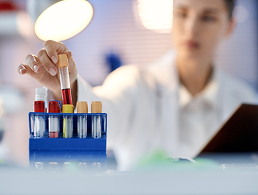 Laborant lucrând cu teste medicale