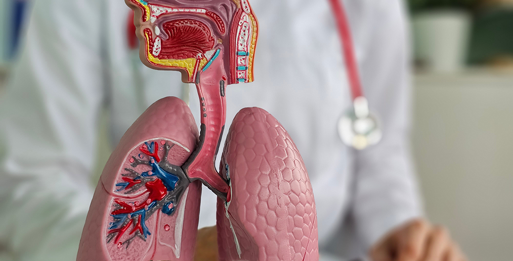plamani-anatomie-cancer-pulmonar