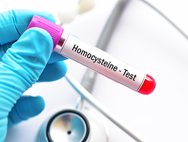 Proba-de-sange-pentru-analiza-homocisteinei