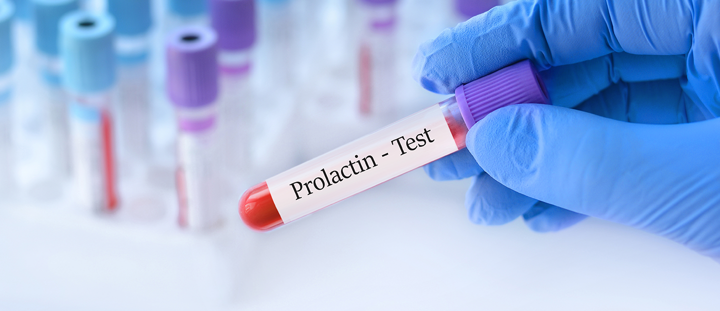 Alimente care scad prolactina: ce să mănânci și ce să eviți