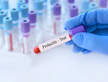 Eprubeta-cu-proba-de-sange-pentru-testarea-prolactinei