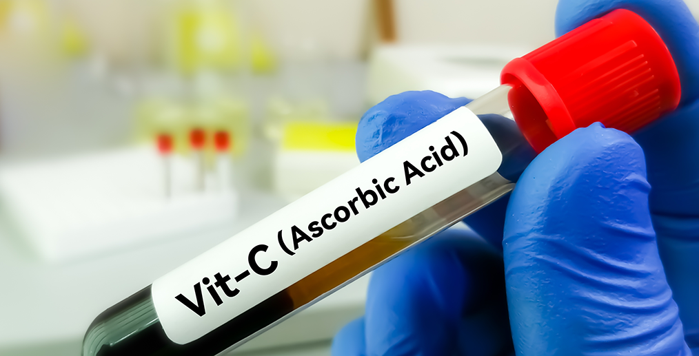 Eprubetă cu probă de sânge pentru determinarea concentrației de vitamina C 