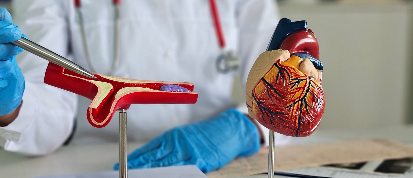 Trombofilia: cauze, simptome, analize de diagnostic și tratament