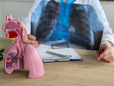 Medicul analizează modificările pulmonare specifice fibrozei