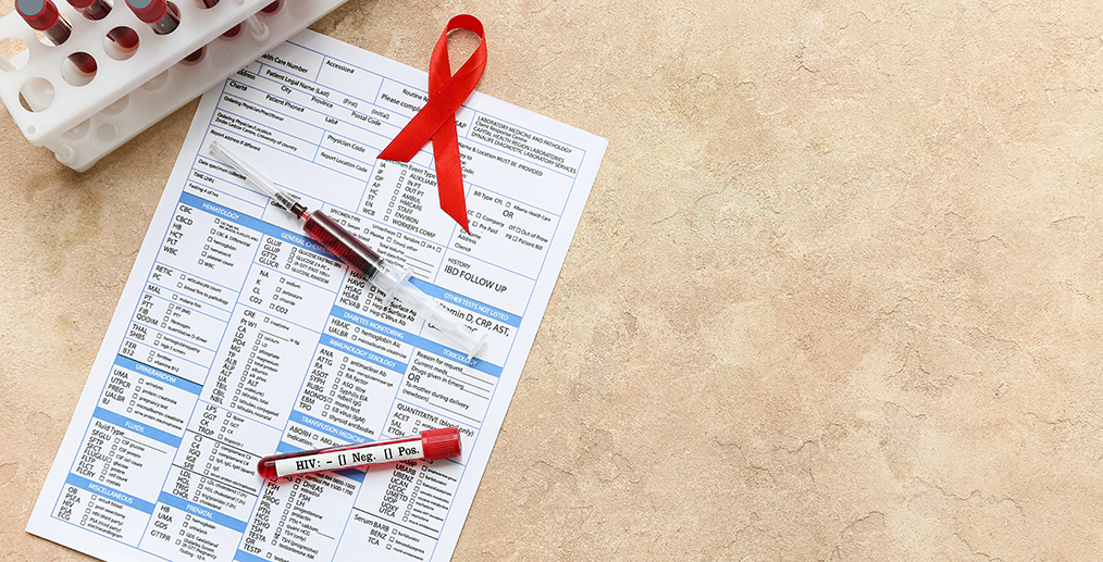 eprubeta-testare-hiv